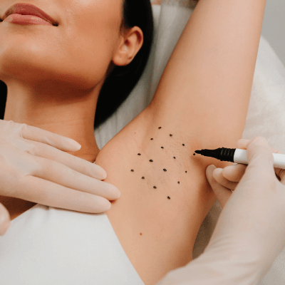 Hyperhidrosis Treatment