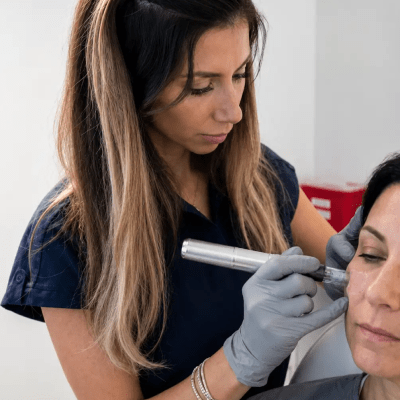 Microneedling